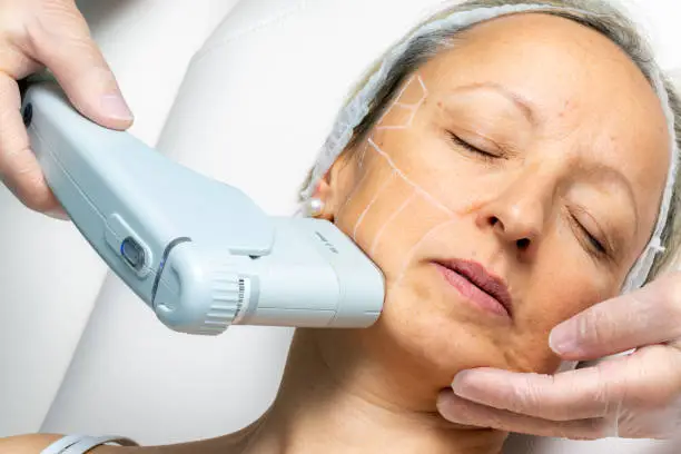 Professional facial treatment at Ilse Skincare